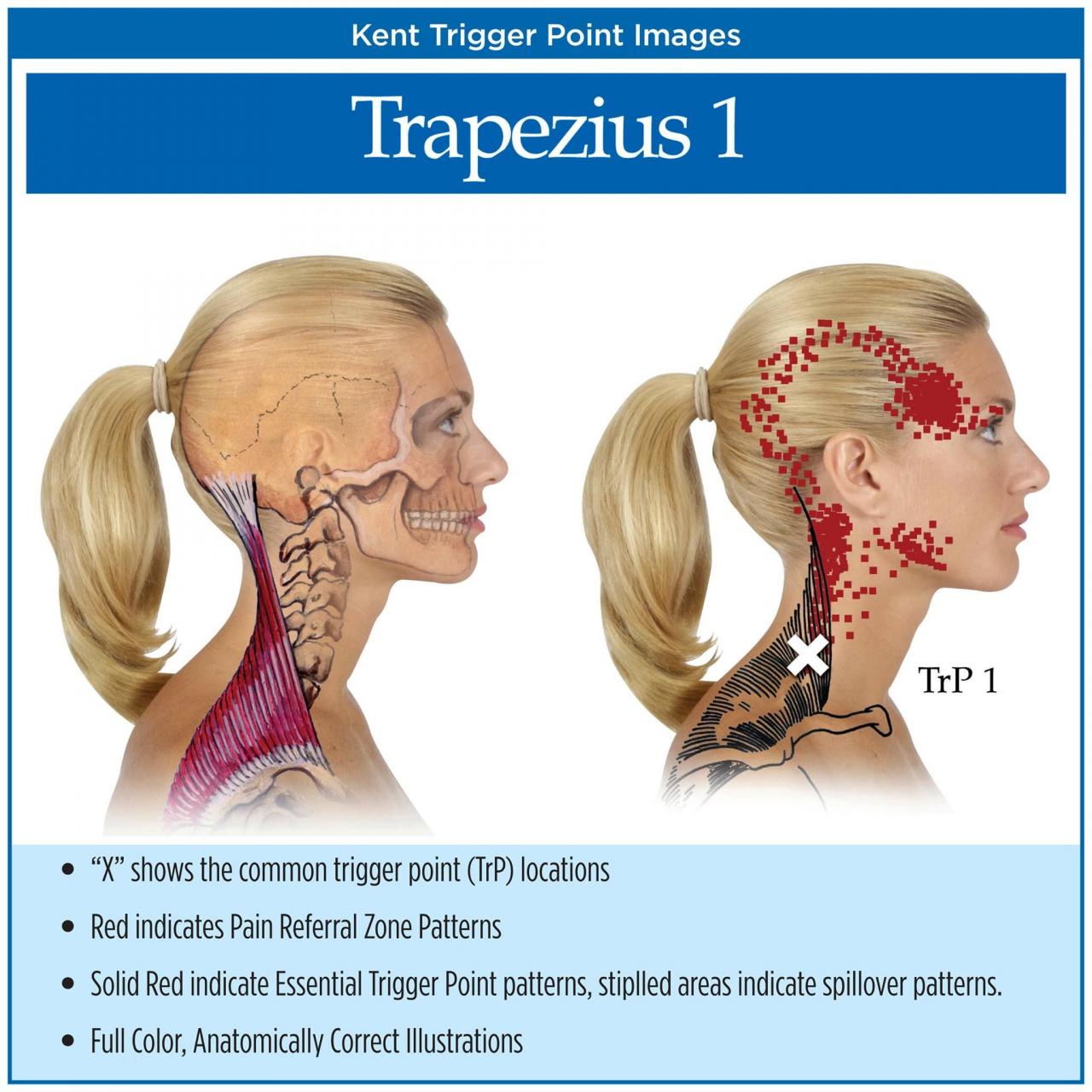 Stiff syndrome sps symptoms causes neurological healthtian tissues complications